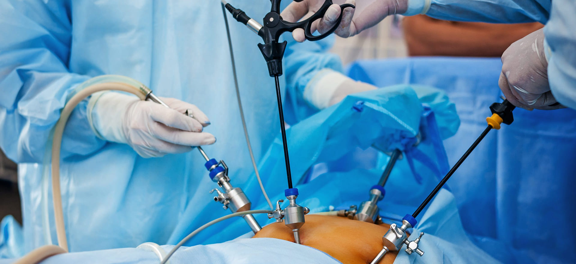 Laparoscopic Surgery Procedure - Banner Image